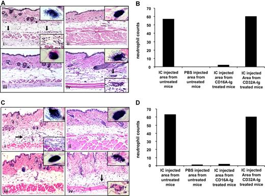 Figure 4. Histologic examination and evaluation of neutrophil infiltration in skin biopsies from anti-Ova injected areas of mice treated with or without FcγR dimers. (Ai) Skin biopsy from anti-Ova antibody–injected area in an untreated mouse with RPA (from Figure 3Ai site 3). The epidermis and dermis are essentially unremarkable. However, the subdermal fat is edematous and shows the margination of neutrophils along capillary walls (arrows; bottom inset) as well as neutrophilic infiltration into surrounding soft tissue. (Aii) Skin biopsy from PBS-injected area in an untreated mouse with RPA (from Figure 3Ai site 1). No specific pathologic changes are identified. (Aiii) Skin biopsy from anti-Ova antibody injected area in a mouse treated with 50 μg/mL CD16A-Ig before the induction of RPA (from Figure 3Avii site 3). No specific pathologic changes are identified, suggesting abrogation of the Arthus reaction. (Aiv) Skin biopsy from anti-Ova antibody injected area in a mouse treated with 50 μg/mL CD32A-Ig before the induction of RPA (from Figure 3Aii site 3). The epidermis and dermis are essentially unremarkable. However, the subdermal fat is edematous and shows neutrophilic infiltrates in soft tissue (similar to Figure 3Ai), as well as scattered foci of leukocytoclastic vasculitis (arrows; bottom inset). Top inset: Mast cell degranulation was observed in 10 different sites at 100x magnification and one of the cells is represented in the figure inset. (B) Neutrophils were counted in 10 random sites at 63x magnification and sum of the neutrophils were represented. C: To deplete the complement, mice were twice injected intraperitoneally with cobra venom factor before the initiation of RPA. The mice were injected with CD16A-Ig and CD32A-Ig intravenously (50 μg/mL of blood). After 1 hour, mice were injected intradermally with 25 μg of anti-Ova per site. (Ci) Skin biopsy from anti-Ova antibody injected area in an untreated mouse with RPA. The epidermis and dermis are essentially unremarkable. However, the subdermal fat is edematous and shows the margination of neutrophils along capillary walls (arrows; bottom inset) as well as neutrophilic infiltration into surrounding soft tissue. (Cii) Skin biopsy from PBS injected area in an untreated mouse with RPA. No specific pathologic changes are identified. (Ciii) Skin biopsy from anti-Ova antibody injected area in a mouse treated with 50 μg/mL CD16A-Ig before the induction of RPA. No specific pathologic changes are identified, suggesting abrogation of the Arthus reaction. (Civ) Skin biopsy from anti-Ova antibody injected area in a mouse treated with 50 μg/mL CD32A-Ig before the induction of RPA. The epidermis and dermis are essentially unremarkable. However, the subdermal fat is edematous and shows neutrophilic infiltrates in soft tissue, as well as scattered foci of leukocytoclastic vasculitis (arrows; bottom inset). Top inset: Mast cell degranulation was observed in 10 different sites 100x magnification and one of the cells is represented in the Figure inset. (D) Neutrophils were counted in 10 random sites at 63x magnifications and sum of the neutrophils were represented.