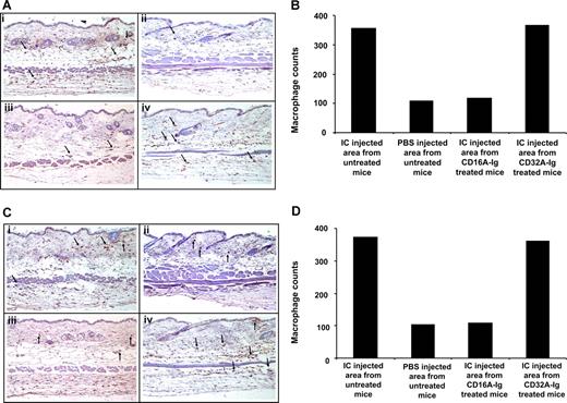 Figure 5. Immunohistochemical examination to detect the macrophages in skin biopsies from anti-Ova injected areas of mice treated with or without FcγR dimers. (A) Skin biopsies of the above mentioned sections were processed to detect the macrophages (brown cells indicated by arrow) by immunohistochemistry. (Ai) Accumulation of macrophages in anti-Ova antibody injected area of untreated mice. (Aii) Presence of resident macrophages in PBS injected area of untreated mice. (Aiii) Inhibition of macrophage accumulation in anti-Ova antibody injected area of CD16A-Ig treated mice. (Aiv) Accumulation of macrophages in anti-Ova antibody injected area of CD32A-Ig treated mice. (B) Macrophages were counted in 10 random sites at 63x magnification and the sum of the macrophages is presented. (C) Skin biopsies of the above mentioned sections from complement-depleted mice were processed to detect the macrophages (brown cells indicated by arrow) by immunohistochemistry. (Ci) Accumulation of macrophages in anti-Ova antibody injected area of untreated mice. (Cii) Presence of resident macrophages in PBS injected area of untreated mice. (Ciii) Inhibition of macrophage accumulation in anti-Ova antibody injected area of CD16A-Ig treated mice. (Civ) Accumulation of macrophages in anti-Ova antibody injected area of CD32A-Ig treated mice. (D) Macrophages were counted in 10 random sites at 63x magnification and the sum of the macrophages is presented.