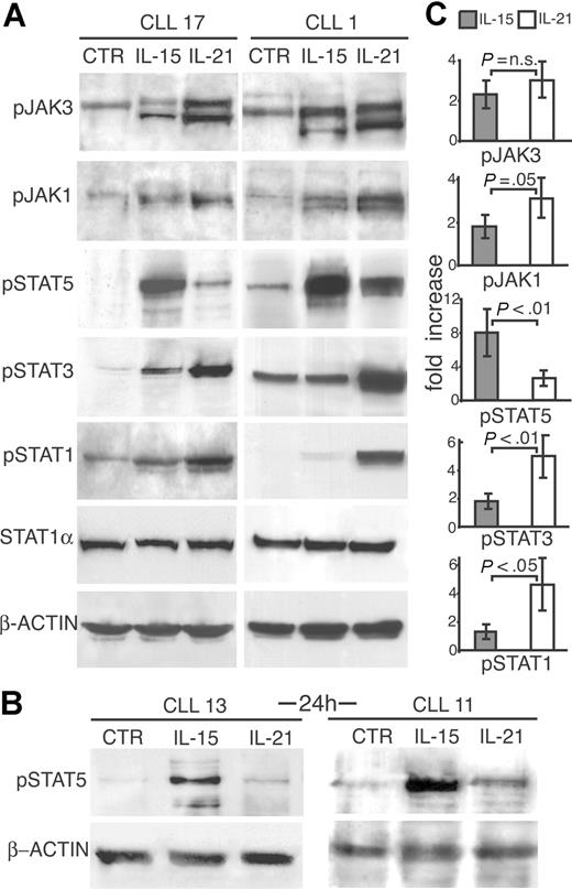 Figure 4. Comparison of JAK/STAT signaling pathways activated by IL-15 or by IL-21 shows remarkable differences. (A) CLL cells from 2 representative cases were stimulated with IL-15 or IL-21 (80 ng/mL) or medium only (CTR) for 10 minutes, lysed in appropriate buffers and analyzed by Western blotting using mAbs specific for tyrosine-phosphorylated (JAK1, JAK3, STAT1, STAT3, and STAT5) or unphosphorylated (STAT1) forms of signal transducer proteins, or for β-actin. (B) CLL cells stimulated by IL-15 for 24 hours show enhanced STAT5 phosphorylation compared with IL-21–treated or untreated cells. (C) Densitometric analysis of Western blots to quantify p-JAK1 and p-JAK3 and p-STAT1, p-STAT3, and p-STAT5 levels following treatment with IL-21 or IL-15. Densitometric measurements of phosphoproteins were normalized to unphosphorylated STAT1 or to β-actin levels, and expressed as fold of increase relative to the untreated control. The mean values (± SD) of 7 different patients and statistical significance are shown.