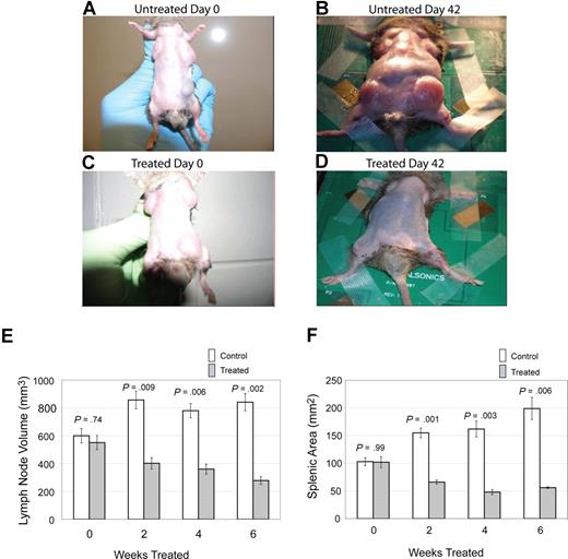 Figure 1. Notch inhibition decreases lymphoproliferation. CBA-lprcg mice were randomized to treatment with DAPT 5mg/kg per day versus vehicle control (6 treated, 9 control). After 6 weeks of treatment, a decrease in disease burden is visually apparent. Shown here are a control animal at (A) initiation and (B) after 42 days of vehicle, and a treated mouse at (C) initiation of DAPT treatment and (D) after 42 days of treatment. Serial ultrasounds were performed every 2 weeks to document lymph-node volume (mm3) and splenic area in (mm2). Treated mice showed a statistically significant (P = .009) decrease in lymph-node volume after 2 weeks of treatment compared with control mice (E). Treated mice also showed a statistically significant (P = .001) decrease in splenic area by 2 weeks of treatment compared with control mice (F). No statistical difference existed between groups at initiation of treatment. Bars represent mean lymph node volume (E) or splenic area (F) from mice at each time point, and error bars represent SEM.