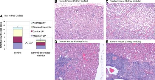 Figure 5. Gamma-secretase inhibitors improve nephropathy. MRL-lpr mice were randomized to treatment with DAPT or vehicle. Eight weeks after starting therapy, mice were killed and kidneys were assessed for disease. Kidney disease burden was scored 0 to 5 on 4 measures: (1) nephropathy; (2) glomerulonephritis; (3) cortical lymphoid proliferation (LP); and (4) medullary lymphoid proliferation (LP). Higher scores represent more severe disease. (A) Average total cumulative score for 4 control and 6 treated animals. Colored portions of the bars depict the individual disease measures. Treated mice demonstrated a reduction in all 4 disease parameters compared with control and a statistically significant reduction in total kidney disease (P = .007). Error bars depict SD of total kidney disease score. (B-E) Kidney pathology by H&E stain. Treated animals have healthy kidneys with limited disease (B,C). In contrast, control animals have pronounced lymphocytic infiltration in cortex (D) and medulla (E). In addition, control animals have damaged glomeruli and proteinaceous material in renal tubules. Images were captured using a Zeiss Axiovert 40C light microscope (Carl Zeiss, Thornwood, NJ) equipped with an apochromatic 10×/0.25 NA objective lens and a Nikon 995 camera (Nikon, Melville, NY).