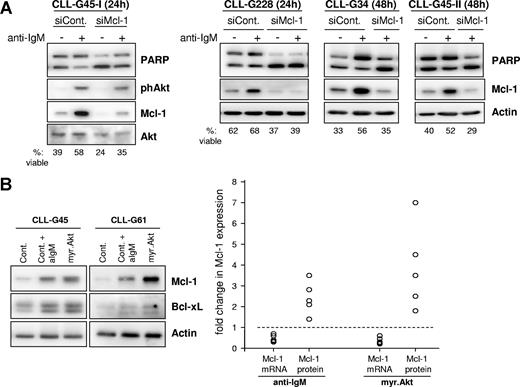 Figure 6. The antiapoptotic effect of sustained BCR signaling is mediated by posttranscriptional regulation of Mcl-1. (A) CLL B cells were transfected with control or Mcl-1 siRNA and stimulated for 24 or 48 hours with immobilized anti-IgM antibodies. Protection from apoptosis was evaluated by PARP cleavage and Annexin V/PI staining. A total of 4 independent experiments are shown. (B) Comparison of changes in Mcl-1 mRNA and protein levels induced by sustained BCR engagement and sustained activation of Akt. CLL B cells from 5 patients were nucleofected with control or myr.Akt mRNA. Cells nucleofected with control mRNA were either left unstimulated or were stimulated with immobilized anti-IgM antibody. All samples were collected 24 hours after nucleofection and analyzed by immunoblotting (left panel) and by real-time RT-PCR. Mcl-1 mRNA and protein levels were normalized to actin and are expressed as fold change relative to corresponding levels in CLL cells transfected with control mRNA, which were set to 1 (dashed line).
