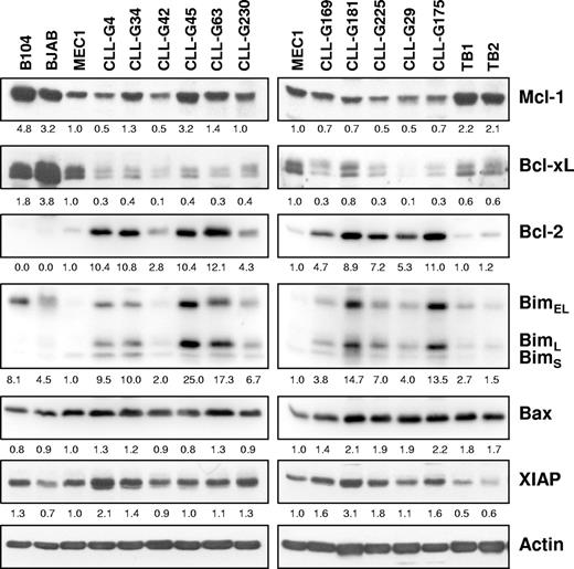 Figure 7. Expression of apoptosis-regulatory proteins in primary CLL B cells and B-cell lines. Immunoblotting analysis was performed with purified CLL B cells from 11 patients, purified normal tonsillar B cells (TB1 and TB2), and the B104, BJAB, and MEC1 cell lines. Actin was used as a loading control. Normalized levels of each protein are expressed as fold change relative to the levels in the MEC1 cell line.