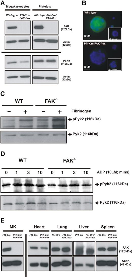 Figure 1. FAK ablation in megakaryocytes and platelets. (A) Bone marrow–derived megakaryocytes and freshly isolated platelets were lysed and FAK and PYK2 protein expression determined by Western blotting. (B) Cytospin preparations of mature bone marrow–derived megakaryocytes are shown, stained for FAK expression (green) and DNA (blue). The staining shown is representative of approximately 50 cells in each group. Relevant immunoglobulin controls are shown as insets. (C) Western blot analyses of phospho-PYK2 in response to fibrinogen and MnCl2 in megakaryocytes and (D) in platelets in response to ADP derived from Pf4-Cre/FAK-floxed and WT mice. (E) Western blot analyses of FAK protein expression by nonmegakaryocytic tissues in Pf4-Cre/FAK-floxed and WT mice.