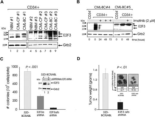 Figure 5. E2F3 is a bona fide target of BCR/ABL tyrosine kinase activity. (A) Western blot shows E2F3a (top arrow) and E2F3b (bottom arrow) protein expression in CD34+ BMCs from a healthy donor (NBM), patients with CML-CP, and patients with CML-BC (n = 3 per group). (B) E2F3 protein levels in the CML-BC (n = 2) CD34− and in untreated or imatinib-treated (for the indicated times) CD34+ BMC fractions. GRB2 was used as a control for equal loading. *Nonspecific band detected by a new lot of the E2F3 antibody. (C) Growth factor–independent methylcellulose colony formation of 32D-BCR/ABL cells transduced with the empty pSUPER.retro.neo + GFP retrovirus (), or with retroviruses carrying shRNA for E2F3a () or E2F3a/b (). Inset: Western blot shows shRNA-mediated E2F3a/b down-regulation. (D) Analysis of tumors from SCID mice subcutaneously injected with vector-transduced () or E2F3a/b shRNA–transduced () 3 2D-BCR/ABL cells.