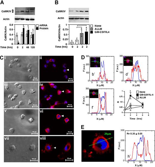 Figure 1. CaMKIV accumulates during differentiation of monocyte-derived dendritic cells. (A) CD14+ mononuclear cells were cultured in the presence of GM-CSF and IL-4. Whole-cell lysates were prepared at the indicated times and analyzed by immunoblot with specific antibodies (CaMKIV and actin). Aliquots of cells were used to measure CaMKIV and actin mRNA levels by quantitative reverse transcription–polymerase chain reaction. Bottom panel shows mean (± SD) of optical density measurements expressed as the ratio between the CaMKs and actin bands (n = 4). *P < .01. (B) Calpain regulates CaMKIV accumulation in differentiating monocytes. CD14+ mononuclear cells were cultured in the presence of ALLM, a selective calpain inhibitor (ALLM), or GM-CSF and IL-4 and analyzed for CaMKIV expression by immunoblot (top). The bottom panel shows mean (± SD) of the optical density measurements expressed as the ratio between the CaMKIV and actin bands (n = 4). *P < .01. (C-E) Intracellular distribution of CaMKIV in differentiating monocytes. (C) Transmission and confocal fluorescent immunocytochemistry images of CaMKIV expression in monocytes cultured for: 2 hours in regular medium (i,ii); 2 hours in the presence of GM-CSF/IL-4 or ALLM (iii, iv, v, and vi, respectively); and 120 hours in the presence of GM-CSF/IL-4 (vii,viii). (D) Line profiles of cells indicated by white arrows in the corresponding subpanels in panel C. The line segment is 20 μM; F indicates the fluorescence intensity in arbitrary units (a.u.). The bottom right graph shows the ratio (R) between the mean fluorescence intensity of Alexa Fluor 594 (CaMKIV) and Hoechst 33342 (nuclear staining) in the nuclear region along different line profiles. Means (± SD) represent 20 independent line profiles. *P < .01. (E) Expression and line profile analysis of CaMKIV in monocytes treated for 120 hours with GM-CSF/IL-4..