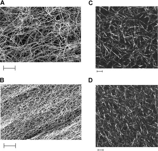 Figure 2. Scanning electron micrographs (EM) and laser scanning confocal microscopy (LSCM) of BβArg448 and BβLys448 fibrin clots. Panels A and B represent EM of clots prepared from recombinant fibrinogen Arg448 and Lys448, respectively, at a concentration of 1.3 μM in the presence of 2.5 mmol CaCl2 and 0.5 U/mL thrombin (magnification, ×10 000). Panels C and D represent LSCM of clots prepared from recombinant fibrinogen Arg448 and Lys448, respectively, at 1.3 μM using 5 mmol CaCl2 and 0.5 U/mL thrombin. Scale bars on all micrographs indicate 5 μm. Complete microscopy information can be found in “Methods.”