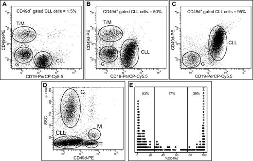 Figure 1. Characteristics of CD49d expression. (A-C) Flow cytometric dot-plots of CD19-PerCP-Cy5.5 vs CD49d-PE expression on PB samples of 3 representative CLL cases; the reported percent values of CD49d-expressing cells are calculated on the gated CD5+CD19+ CLL population. T cells (T), monocytes (M), granulocytes (G), and CLL cells (CLL) are indicated in dot-plots. (D) Flow cytometric dot-plot of the physical parameter side-scatter (SSC) vs CD49d-PE expression; T cells, monocytes, granulocytes, and CLL cells are indicated as above; the dot-plot corresponds to CLL reported in panel B. (E) Stacked strip-plot of ordered CD49d percent expression values. Reported percent values refer to the amount of cases expressing low (< 25%), intermediate (25%-75%), or high (> 75%) percentages of CD49d.