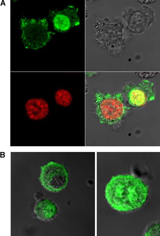 Figure 6. Staining of OH-2 cells in interphase and patient cells in interphase and metaphase with PRL-3. Goat polyclonal antibody against PRL-3 is shown in green. Nuclei visualized with Draq 5 are shown in red. (A) OH-2 cells in interphase. (B) Patient cells in interphase and metaphase. Examination by confocal microscopy.