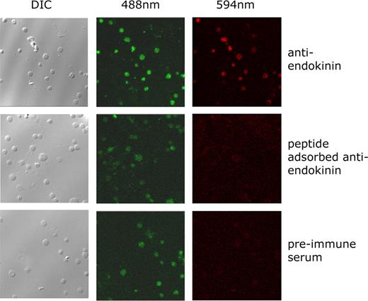 Figure 5. EKA/B immunoreactivity is present in human platelets. Human platelets were labeled with the lipophilic fluorescent dye DIOC6, applied to glass coverslips, and fixed. Platelets were visualized by DIC microscopy and confocal microscopy at 488 nm. Endokinin expression in platelets was detected at 594 nm using an antiendokinin antibody and Texas red–conjugated secondary antibody. Parallel control experiments were performed using preimmune antiserum, and antiendokinin antiserum to which immunogen antibody had been previously added (peptide-adsorbed antiendokinin). Confocal fluorescence microscopic data represent composite images. Data are representative of 4 separate experiments.