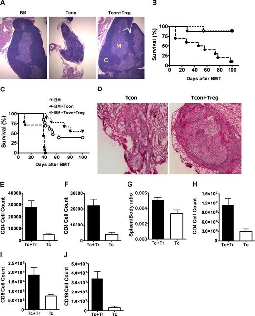 Figure 4. Protection of thymic stroma and secondary lymphoid organs by regulatory T cells improves T-cell immunity. (A) H&E staining of thymus extracted from Balb/c recipients which received FVB TCD-BM alone (BM), with Tcons (Tcon), or with Tcons and Tregs (Tcon + Treg) (200 × magnification). Results from day 60 show small and involuted thymus with disorganized medullary, M, and cortical, C, regions in Tcon recipients compared with animals that received Tcons and Tregs. (B,C) Survival of adult thymectomized Balb/c recipients co-transplanted with BM alone (▾), with Tcons (●) or with Tcons and Tregs (O), uninfected (B). ●, n = 10 vs O, n = 9, P = .001), or challenged with MCMV on day 30 after transplantation (C): ●, n = 14 vs O, n = 13, P < .001). P is NS for BM versus Tcon + Treg. Data combined from 2 separate experiments. (D) H&E staining of peripheral lymph node sections from Balb/c recipients, which had received donor FVB TCD-BM with Tcons alone (Tcon) or with Tcons and Tregs (Tcon + Treg) on day 60 after transplantation (200 × magnification). In Tcon recipients, peripheral lymph nodes are collapsed with hyalinalization and hypoplasia. (E,F) Number of CD4+ and CD8+ T cells in peripheral lymph node of animals with Tcons alone (Tc, ▭) or with Tcons and Tregs (Tc + Tr, —) (CD4+, P = .002; CD8+, P = .002). (G-J). Spleen to body weight ratio (P = .037) and number of CD4+ (P = .011), CD8+ (P = .032), and CD19+ cells (.006) in spleens of animals that received BM and Tcons alone (Tc, ▭) or with BM with Tcons and Tregs (Tc + Tr, —). Data shown for day 60, representing at least 4 animals, with mean values (± SE).