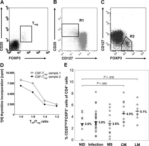 Figure 1. Treg cells accumulate in the CSF of patients with NM. (A) Typical FACS staining of CSF cells (sample obtained from 1 patient with LM) for surface CD25 and intracellular FOXP3. For quantification of Treg cells, stained CSF cells were first gated according to forward and side light-scattering properties and CD4 expression, and then coexpression of FOXP3 and CD25 was assessed. (B) After staining for CD4, CD25, CD127, and FOXP3, cells were gated for CD4+ lymphocytes. (B) R1 shows CD4+CD25highCD127low cells. (C) R2 shows CD4+FOXP3+CD127low cells. (D) In vitro proliferation assay with 104 control-derived Teff cells and increasing numbers of CD4+CD25high Treg cells isolated from CSF samples obtained from 2 patients with viral infections. CSF-derived Treg cells suppress proliferation of activated Teff cells in a dose-dependent manner. (E) Percentages of CD25highFOXP3+ Treg cells among CD4+ CSF cells in patients with NM and control diseases. Symbols indicate percentages of individual patients. Medians are indicated.