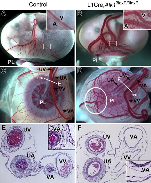 Figure 4. Alk1 deletion resulted in abnormal extraembryonic vasculature in E16.5 L1cre(+);Alk13loxP/3loxP fetuses. (A,B) Gross morphology of control and L1cre(+);Alk13loxP/3loxP mutant fetuses enclosed in the yolk sac attached to the placenta (PL). Note bulged arteries (A) and veins (V) in the mutant yolk sac. The inset in panel B shows magnified view of typical dilated, tortuous vitelline vessels in the mutants. (C,D) Umbilical arteries (UA) and veins (UV) are connected to the placenta, whereas vitelline arteries (VA) and veins (VV) are connected to the yolk sac. Note markedly enlarged VA and AVMs (circled; see enlarged view in Figure 5D) in the mutants. (E,F) Cross-sectional view of the extraembryonic vessels indicated by the scissors symbols in panels C,D demonstrates marked dilation and thinning of mutant VA (F), which has a similar morphology as control VV (E).