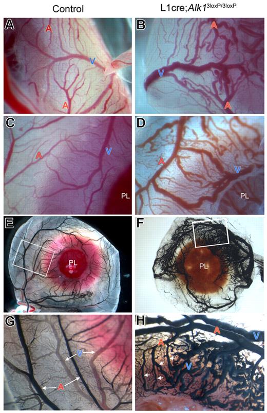 Figure 5. Alk1 deletion results in multiple AVM formations. Dissection microscopic views of representative arteries (A) and veins (V) in control (A,C,E,G) and L1cre(+);Alk13loxP/3loxP (B,D,F,H) E16.5 embryonic yolk sacs. In the control yolk sac (A,C), arteries and veins are intercalating and not connected directly to one another. In the mutants (B,D), however, there are numerous regions where dilated and tortuous arteries and veins are directly connected without the connecting capillaries. (E-H) India ink was injected into the vitelline artery to visualize the yolk sac vessels. In control (E,G), arteries and veins were easily distinguishable and were connected by capillaries. In mutants (F,H), numerous AVMs (indicated by arrows) were formed between arteries and veins.