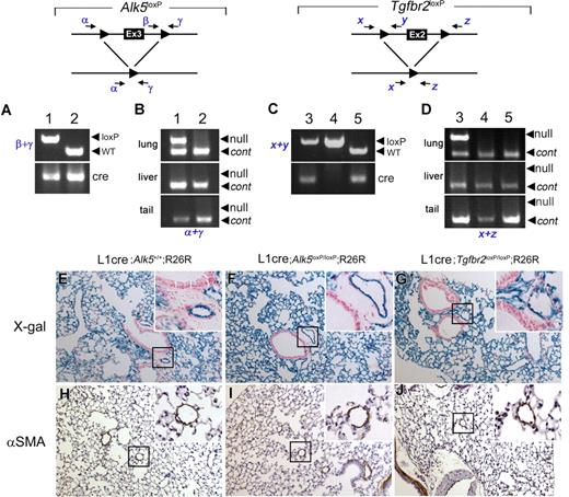 Figure 7. The Alk5 and Tgfbr2 are deleted in the lungs of L1cre(+);Alk5loxP/loxP and L1cre(+);Tgfbr2loxP/loxP mice, respectively, yet no noticeable pathologic signs were observed in the lungs of 2-month-old mutants. (A) PCR genotyping with primers β and γ (top) and Cre (bottom), showing L1cre(+);Alk5loxP/loxP (lane 1) and L1cre(+);Alk5+/+ (lane 2) mice. WT, wild-type allele (B) PCR amplification of the Alk5 null allele is specific for the lung. Genomic DNA isolated from the lung (top), liver (middle), and tail (bottom) were used as template to amplify the null allele by primers α and γ. Another primer set detecting a diploid genome (ie, Alk1 = control) was also included in the PCR reaction to demonstrate equal loading of the template. (C) PCR genotyping with primers x and y (top) and cre (bottom), showing L1cre(+);Tgfbr2loxP/loxP (lane 3), L1cre(−);Tgfbr2loxP/loxP (land 4), and L1cre(+);Tgfbr2+/+ (lane 5) mice. (D) PCR amplification of the Tgfbr2 null allele is specific for the lung. Genomic DNA isolated from the lung (top), liver (middle), and tail (bottom) was used as template to amplify the null allele by primers x and z. Another primer set detecting a diploid genome (ie, Alk1) was also included in the PCR reaction to demonstrate equal loading of the template. (E-J) Histologic sections of the lungs of 2-month-old control (ie, L1cre(+);Alk5+/+;R26R; E,H), L1cre(+);Alk5loxP/loxP;R26R (F,I), and L1cre(+);Tgfbr2loxP/loxP;R26R (G,J) mice. (E-G) Histologic sections of the X-gal stained lungs were counterstained with NFR, demonstrating that the Cre–mediated recombination has occurred in these lungs as expected. Insets are high magnification views showing that lacZ expression is restricted to pulmonary ECs, not in bronchial epithelial or smooth muscle cells. (H-J) Anti-αSMA antibody staining of the control and mutant lungs showing no specific pathologic signs. Insets show that similar thickness of the VSMC layers of distal arteries.