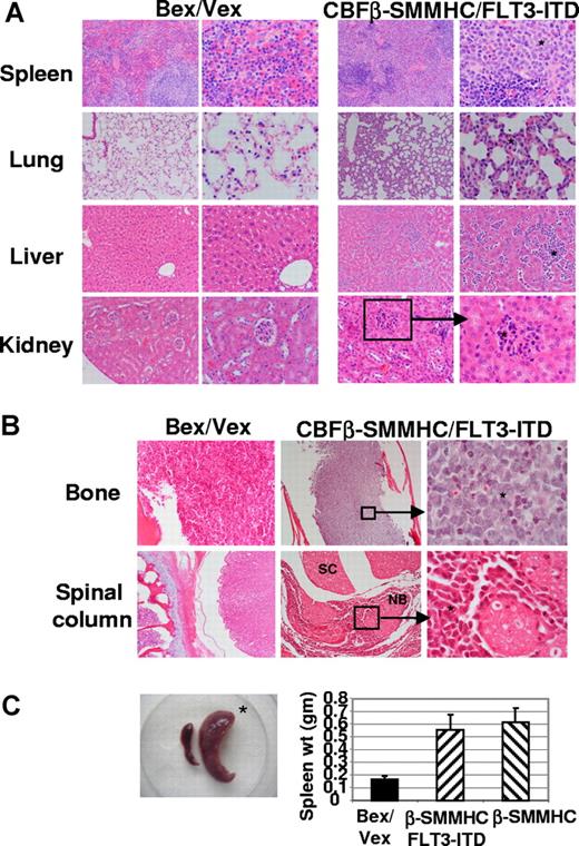 Figure 2. Dissemination of leukemic cells into peripheral organs and tissues. (A) Hematoxylin and eosin staining of tissues from Bex/Vex control and leukemic CBFβ-SMMHC/FLT3-ITD mice. Data are representative of a minimum of 5 moribund CBFβ-SMMHC/FLT3-ITD animals. Original magnifications in the left and right columns for Bex/Vex and CBFβ-SMMHC/FLT3-ITD, ×150 and ×250, respectively, except for 3 panels that were at ×100 (left panels of control and CBFβ-SMMHC/FLT3-ITD spleen and left panel of control kidney) and 1 panel at ×500 (right panel of CBFβ-SMMHC/FLT3-ITD kidney). * Leukemic infiltrates in various tissues. (B) Representative sections of femur or spinal column stained with hematoxylin and eosin (original magnifications: bone: ×150, left panel; ×50 center panel; ×500 right panel; spinal column: ×50, left; ×50 center; ×500, right panel). SC indicates spinal cord; NB, nerve bundle. (C) Splenomegaly was observed in all CBFβ-SMMHC/FLT3-ITD mice (n = 17) (*). (Bar graph) Spleen weight (grams, means ± SD) for Bex/Vex controls (n = 6), CBFβ-SMMHC (n = 6), and CBFβ-SMMHC/FLT3-ITD mice (n = 7).