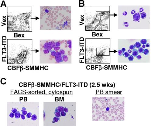 Figure 3. Myelopoiesis in CBFβ-SMMHC/FLT3-ITD mice. (A) Representative peripheral blood smears from 2-month posttransplantation Bex/Vex (control) or CBFβ-SMMHC/FLT3-ITD mice indicating a high percentage of immature myeloid blasts in CBFβ-SMMHC/FLT3-ITD mice (original magnification ×500). (B) Wright-Giemsa staining of FACS–sorted Bex+/Vex+ cells from bone marrow of control or CBFβ-SMMHC/FLT3-ITD mice at 2 months after transplant. (C) Bex+/Vex+ cells were sorted from bone marrow or peripheral blood of CBFβ-SMMHC/FLT3-ITD mice at 2.5 weeks after transplant and cytospun onto glass slides for Wright-Giemsa staining (n = 3). A peripheral blood smear from the same animal used for isolation of FACS-sorted cells is shown at right.