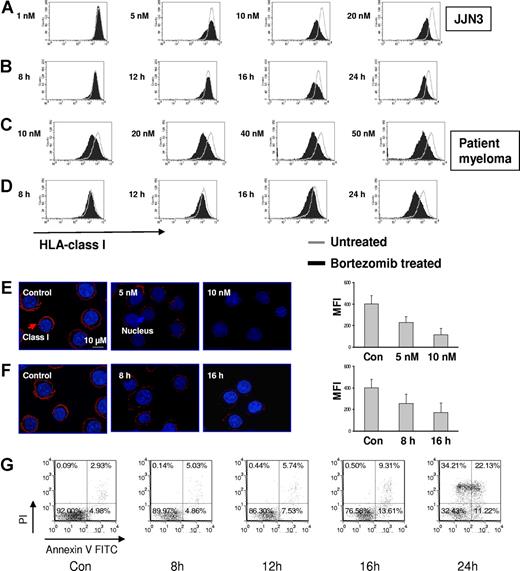 Figure 2. Bortezomib reduces HLA class I expression on JJN3 and primary MM in a dose- and time-dependent fashion. MM cells were incubated with various doses of bortezomib for indicated times. PI-negative cells were gated and analyzed for class I expression. (A) Dose response: JJN3 was exposed to increasing doses of bortezomib for 24 hours. (B) Time course: JJN3 cells were incubated at 10 nM bortezomib for increasing durations of time. (C) Dose response: Patient MM was exposed to increasing doses of bortezomib for 24 hours. (D) Time course: Patient MM was incubated at 10 nM bortezomib for increasing durations of time. Class I expression was also tested on JJN3 after bortezomib by spinning-disc confocal microscopy. (E) Dose response: JJN3 was exposed to increasing doses of bortezomib for 24 hours. (F) Time course: JJN3 cells were incubated at 10 nM bortezomib for increasing durations of time. Images were acquired using a Zeiss Axiovert 200M microscope (Carl Zeiss) fitted with a BD Bioimaging CARV II spinning-disc confocal accessory. Mid-cell confocal images were presented (original magnification, ×250). The fluorescence intensity was quantified using IPLab version 3.9.5 software and corrected by substracting the blank field intensity. A total of 30 cells per group from 3 independent experiments were considered and the mean intensity (± SD) was plotted. (G) The kinetics of apoptosis on JJN3 after drug treatment. JJN3 was treated with 10 nM bortezomib for indicated times. Cells were stained with annexin V and PI and analyzed by FACS. The data represent 1 of 3 individual experiments. The percentages are shown of cells that are annexin V and PI double negative (lower left quadrant), double positive (upper right quadrant), solely annexin V positive (lower right quadrant), and solely PI positive (upper left quadrant).