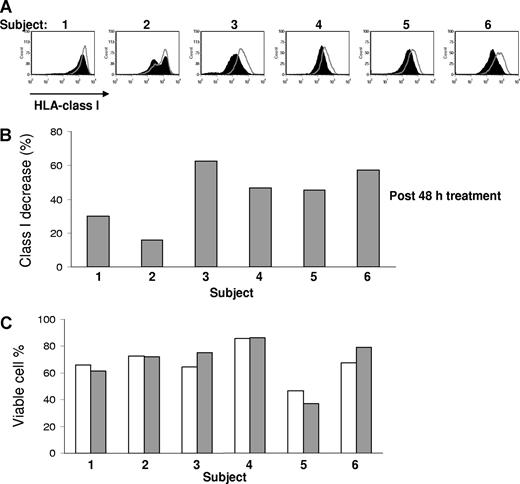 Figure 4. Bortezomib down-regulates HLA class I in vivo on patient MM cells. Comparison of surface expression of HLA class I on the pretreatment and posttreatment of primary MM cells from 6 patients. The paired samples were cryopreserved, simultaneously thawed, and analyzed in the same experiment. PI-negative cells were analyzed for HLA class I expression. Open curves were before bortezomib. The black curves were 48 hours after a single dose of bortezomib 1.0 mg/m2. The percentage of class I expression decrease was determined by 100 × (MFI of pretreatment sample − MFI of posttreatment sample)/MFI of pretreatment sample. Statistically significant difference of class I expression between the pre- and post- bortezomib treatment samples was present (P = .002, Student t test). The viability of pretherapy (▭) and after therapy () samples after thawing was similar.
