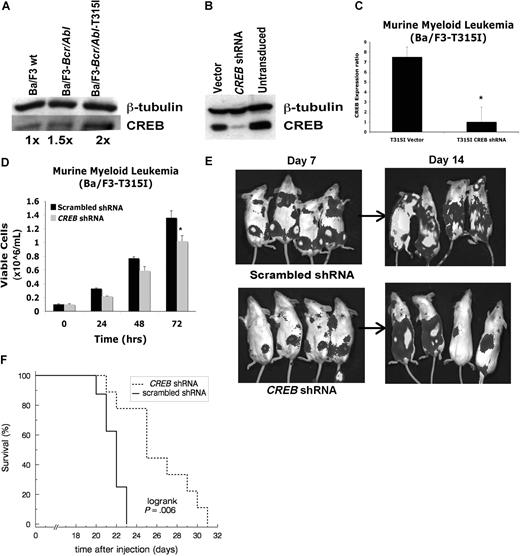 Figure 6. CREB inhibits progression of leukemia in vivo. (A) Western blot analysis with CREB and tubulin antisera, demonstrating 2-fold increase in expression of CREB in T315I mutant of Bcr-Abl in murine pro-B lymphocyte line (Ba/F3) compared with wild-type Ba/F3 cells. (B) Western blot analysis after lentiviral transduction with CREB shRNAs demonstrating 90% inhibition. (C) Quantitative reverse transcription-PCR showing diminished CREB mRNA levels in transduced Ba/F3 T315I cells. (D) Trypan blue exclusion method performed in triplicate shows diminished growth after transduction with CREB shRNA compared with empty vector. (E) Bioluminescence imaging of SCID mice injected with 106 cells transduced with CREB shRNA or CREB scrambled shRNA lentivirus. Mice were imaged at days 7 and 14. Tumor burden is lower in CREB shRNA–injected mice. (F) Kaplan-Meier survival analysis of mice injected with 5 × 105 cells showing longer survival with CREB knockdown (n = 9) compared with scrambled shRNA (n = 9). All deaths were due to leukemia, except for a day 7 handling event in the scrambled group treated as a censored observation. Error bars in panels C and D represent SE.