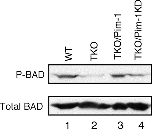 Figure 7. Pim mediates phosphorylation of Ser112 of BAD in v-Abl–transformed cells. Shown is a blot probed as indicated. Lane1, wild-type cells; 2, Pim-1−/−/Pim-2−/−/Pim-3−/− (TKO) cells; 3, TKO cells expressing Pim-1; 4, TKO cells expressing Pim-1 kinase-dead (Pim-1KD).
