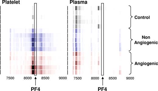 Figure 1. Identification of the platelet- and plasma-derived candidate proteins. Platelets were harvested from mice bearing nonangiogenic or angiogenic xenografts of human liposarcoma at 30 days after tumor implantation and compared with those of their littermate controls using a standard SELDI-ToF biomarker discovery method. A spectral readout from SELDI-ToF MS is presented here in gel view format, and groups are color-coded for clarity. Gray represents protein content of platelets from control animals; blue, from mice bearing the nonangiogenic dormant clone; and red, from mice bearing the angiogenic clone. A differentially expressed protein was observed at 8206 Da. The candidate peptide (↑) was later analyzed and identified as PF-4. Each horizontal strip represents an individual mouse sample (n = 5), and the color intensity corresponds to the height of the protein peak. The experiment was reproduced on 2 independent occasions for a total of 15 mice per group.