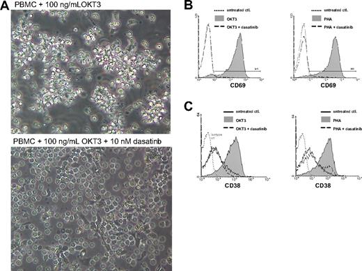 Figure 2. Dasatinib inhibits TCR-mediated activation of primary human T cells. (A) PBMCs were cultured with OKT3 in the absence (top) or presence (bottom) of dasatinib for 4 hours (original magnification, ×400). (B,C) PBMCs were stimulated with OKT3 (100 ng/mL) or PHA (0.5%) in the presence or absence of dasatinib (10 nM). T cells were analyzed for CD69 expression after 20 hours (B) or CD38 after 72 hours (C) by flow cytometry. Solid gray, OKT3 or PHA stimulation; dashed lines, stimulated T cells in the presence of 10 nM dasatinib; dotted lines, control.
