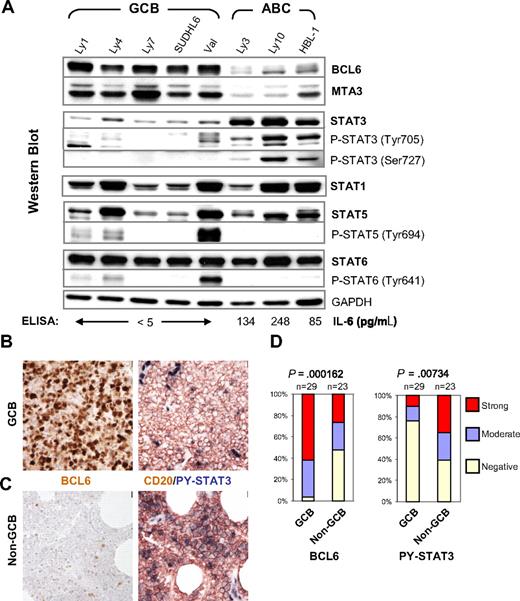 Figure 1. High-level STAT3 expression and activation are preferentially associated with the BCL6-low ABC-DLBCL. (A) IL-6 production, expression, and activation of STAT3 are inversely correlated with BCL6 in DLBCL cell lines. Protein expression of BCL6, MTA3, total and phosphorylated forms of STAT1, STAT3, STAT5, and STAT6 was analyzed by Western blot. GAPDH levels were used as loading control. The COO status of the cell lines are labeled on the top. The titers of secreted IL-6 as measured by ELISA are given at the bottom of the panels. (B,C) Representative IHC staining for BCL6 and CD20/PY-STAT3 in serial sections. (B) Staining of a GCB case that is positive for BCL6 but negative for PY-STAT3. (C) Staining of a non-GCB case that has very few BCL6-positive malignant cells but is strongly positive for PY-STAT3. Note strongly positive endothelial cell nuclei as endogenous positive controls for PY-STAT3 staining. Scale bar = 1 μm (40×). (D) Distribution of BCL6 and PY-STAT3 staining in GCB and non-GCB subgroups. The staining was scored as described in the Document S1. The association between BCL6 expression and DLBCL subgroups or PY-STAT3 and the subgroups was tested by chi-square analysis.