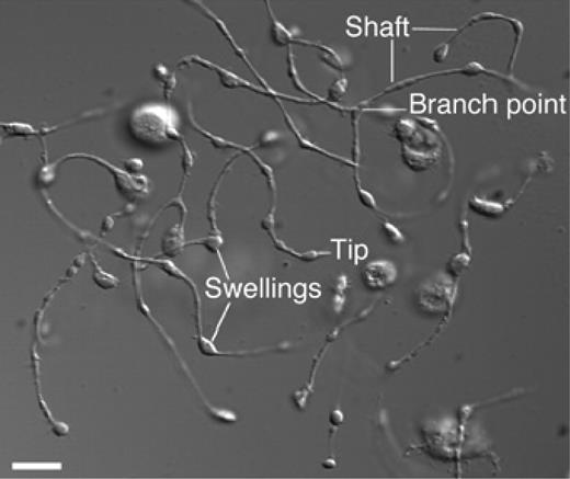 Figure 1. Proplatelet processes. A differential interference contrast micrograph of several proplatelets is shown with the hallmark features, long thin shafts, branch points, and tip swellings. Reprinted with permission from Patel and colleagues.66