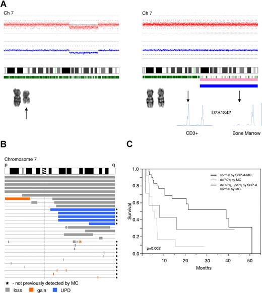 Figure 3. Detection and comparison of different types of lesions, including UPD, that affect chromosome 7 and influence the survival. (A) Two types of lesions resulting in LOH. Left portion demonstrates a deletion spanning part of the long arm of chromosome 7, shown here as reduction of copy number detected by SNP-A, which is concordant with MC finding (black arrow). Right portion demonstrates copy number neutral LOH (UPD), shown here as normal copy number (SNP-A) and normal karyogram by MC. Pink and blue bars below the idiogram indicate areas of LOH, with the thicker the blue bar the higher the probability of LOH. LOH was confirmed by MS genotyping using CD3+ cells as a nonclonal control. MS marker ID is displayed. Arrow indicates the allelic discrepancies. Location and type of lesions (loss-gray, gain-orange, upd-blue) affecting chromosome 7 are shown (B). Lesions previously not found by MC are marked with a black star. Kaplan-Meier analysis of the survival of patients (irrespective of the treatment received) with −7/del(7q) by MC and with new lesions affecting chromosome (del(7q)/upd(7q)) compared with patients with normal SNP-A analysis (C).