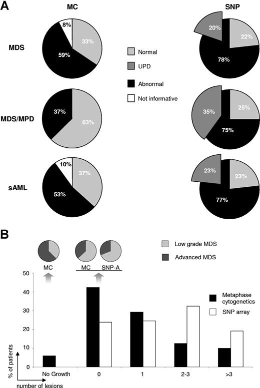 Figure 5. Type, frequency, and number of lesions detected by MC and SNP-A. (A) The frequency of chromosomal aberrations and noninformative results as detected by both MC and SNP-A. The insert in the SNP-A pie chart shows the portion of acquired UPD, either as the sole change or in addition to other abnormalities. (B) The percentage of patients with 0, 1, 2-3, and more than 3 lesions, respectively, as detected by MC (■) and SNP-A (□). Pie charts demonstrate distribution of low versus advanced stage of MDS within noninformative and normal karyotypes detected by MC and SNP-A.