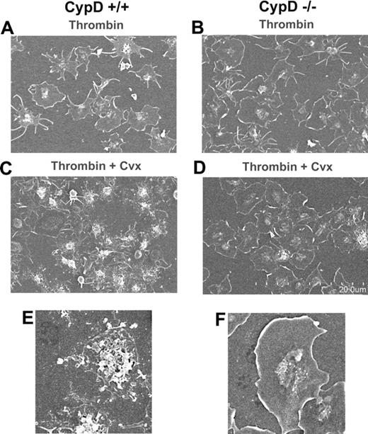 Figure 4. Vesiculation and blebbing of fibrinogen-adherent platelets is impaired in the absence of CypD. Fibrinogen-adherent CypD+/+ or CypD−/− platelets were stimulated with thrombin (0.5 U/mL) (A,B) or thrombin (0.1 U/mL) plus convulxin (Cvx) (50 ng/mL) (C-F) for 2 minutes, fixed, and evaluated by scanning electron microscopy. Scale of the low-magnification images is indicated in panel D. Panels E and F show higher-magnification images of a vesiculated CypD+/+ (E) and spread CypD−/− (F) platelet. Images are representative of 4 separate experiments. Total magnification for panels A, B, C, and D is 2500×; total magnification for panels E and F is 7000×. Complete microscopy information is provided in “Electron microscopy.”