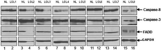 Figure 3. Expression of caspase-8, caspase-3, and FADD protein. The basal protein expression levels of caspase-8, caspase-3, and FADD were determined by Western blot assay using whole-cell lysates from 8 patients with LGL leukemia and from 8 healthy donors. Bands indicate the position of caspase-8, caspase-3, and FADD. Western blot analysis for GAPDH was performed to confirm equal loading of total protein in each lane.