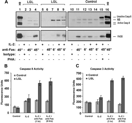 Figure 4. DISC formation in PBMC from LGL leukemia patients and from healthy donors. (A) Fas-mediated DISC formation was determined after 45 minutes and after 6 hours of cross-linking with (500 ng/mL) anti-Fas (APO-1, IgG3) antibody (lanes 1, 3, 4, 6-9, 11-14) in samples from 5 patients with LGL leukemia. Cells were cultured for 24 hours with medium in the absence (−, lanes 1, 3, 6, 7, and 11) and presence of 500 IU/mL IL-2 (+, lanes 2, 4, 5, 8-10, 12, 13) for 24 hours, or PHA (1 μg/mL) plus IL-2 (500 IU/mL) for 5 to 7 days (indicated as PHA in lane 14). IgG3 isotype control antibody (500 ng/mL) was added to demonstrate specificity of protein interactions with the FasR (lanes 2, 5, and 10). After immunoprecipitation and gel electrophoresis, Western blot analysis was performed to detect caspase-8 (top panel) and FADD (bottom panel) in these FasR immunoprecipitates. Immunoprecipitation after anti-Fas antibody cross-linking of H9 cells (T-cell leukemia cell line) was used as a positive control. (B) Whole-cell lysates were prepared from a fraction of cells studied in these immunoprecipitation experiments after 1 and 6 hours of cross-linking with anti-Fas (Apo-1) antibody and isotype control (IgG3). Results shown represent the means (± SEM) of caspase-8, and -3/7 activities that were determined by a fluorometric enzyme activity assay. Protein bands for full-length caspase-8 (casp-8), FADD, and an activated cleaved product of caspase-8 (Ac casp-8) are indicated. NS = nonspecific band observed with the anti-caspase-8 antibody.