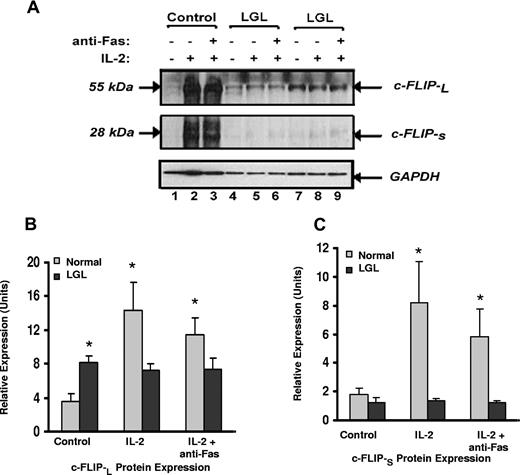 Figure 5. Expression of c-FLIP proteins in samples from patients with LGL leukemia and healthy control subjects. (A) c-FLIP Western blot analysis of whole cell lysates from a representative normal donor (control) and from 2 representative patients with LGL leukemia treated with medium alone, IL-2 (500 IU/mL), or IL-2 plus anti-Fas (APO-1) 1.0 μg/mL for 24 hours before lysis. Western blot analysis for GAPDH was performed to confirm equal loading of total protein in each lane. (B) Densitometry was performed on Western blot results from patients 8 LGL leukemia and 6 healthy control subjects to determine the average level of c-FLIP-L and c-FLIP-S protein expression in medium control (control), IL-2, and IL-2 plus anti-Fas (APO-1)-cultured cells. Indicated on the gel are c-FLIP-L and c-FLIP-S of molecular masses 55 and 28 kDa, respectively. *P ≤ .05.