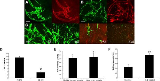 Figure 2. Characterization of CB-EPC–derived vascular networks in vivo. Whole mount staining of the implanted collagen gel revealed that the CB-EPCs (EGFP+) at day 87 after implantation maintained the expression of CD31 (A) and had intact basement membrane of collagen type IV (B) in vivo (EGFP, green; CD31 and collagen type IV, red). CB-EPCs implanted alone at high cell density (5 million cells/mL at high density vs 1 million cells/mL at normal density) were not able to form long-lasting blood vessels (C). The blood-derived endothelial cells were exposed to serum-free media for 48 hours, and the cells were then stained and quantified for TUNEL, a marker for apoptotic cells (D). CB-EPCs exhibited a higher resistance to serum-free medium–induced apoptosis. The vascular permeability of the CB-EPC–derived blood vessels to albumin was measured (Table 1). CB-EPC–derived blood vessels had low vascular permeability with values similar to those of normal mouse pial blood vessels. Blood flow rate as measured by red blood cell (RBC) velocity was comparable between the CB-EPC–derived vessels and mouse brain vessels (E). The number of rolling leukocytes on CB-EPC–derived blood vessels was increased after induction of systemic inflammation with intraperitoneal injection of 100 ng IL-1β for 4 hours (F). #P < .001; *NS; **P < .05. Scale bars (A,B) represent 50 μm.