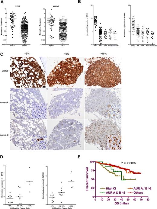 Figure 4. Aurora-A and -B are overexpressed in patients with high CI and are suitable therapeutic targets for these high-risk patients. (A) Among the differentially expressed genes are some candidate genes previously implicated in mediating centrosome amplification. Of these, the expression of both STK6 and AURKB, which code for aurora-A and aurora-B, respectively, was significantly higher in patients with high CI (3.46 ± 2.49 vs 1.07 ± 1.05, t test P < .0001, and 2.60 ± 2.43 vs 0.9 ± 0.85, t test P < .001, respectively) and may represent potentially novel therapeutic targets in these poor-prognosis patients. (B) The expression of aurora-A and -B was significantly higher in HMCLs, and a significant number of tumors (MGUS, SMM, and MM) have expression above normal plasma cells (normalized gene expression greater than 1). (C) Expression of aurora-A and -B was detected by IHC. Staining for aurora-A and -B is cytoplasmic and nuclear, respectively. The staining is generally stronger for aurora-B than -A. For aurora-B staining in the left panel, the positive cells are indicated by close arrows. For both aurora-A and -B staining in the left and right panels, image inserts show area of staining at higher magnification. Images are at 10 × magnification except for image inserts that are at 40×. The images are captured on the Olympus BX51 microscope using the Olympus DP71 CCD camera and MicroSuite 5 software (Olympus Imaging America). Adobe Photoshop CS version 8 is then used to resize the images. (D) Protein expression of aurora-A and -B correlated with gene expression. When the cases with different percentage of positive-staining cells are grouped together, there is a corresponding increase in gene expression in the patients with higher percentage of positive cells (P = .006 for aurora-A and P = .002 for aurora-B), suggesting correlation between gene and protein expression. (E) Survival of patients with high CI (regardless of STK6 or AURB expression, although 80% of patients with high CI have high STK6 and/or AURKB expression) and those overexpressing both STK6 and AURKB is significantly shorter (n = 49 and n = 14, median OS, 42.7 and 39.8 months, respectively, log-rank P = .0005) than patients overexpressing just one of these genes (n = 33, median OS not reached) or those not overexpressing either gene (n = 255, median OS not reached).