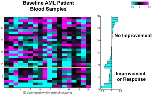 Figure 4. A baseline gene-expression resistance signature in AML patient peripheral blood cells was predictive of clinical outcome. Expression levels of the 17 antioxidant genes in baseline AML patient samples as well as all patients (data not shown) correlated with clinical outcome.