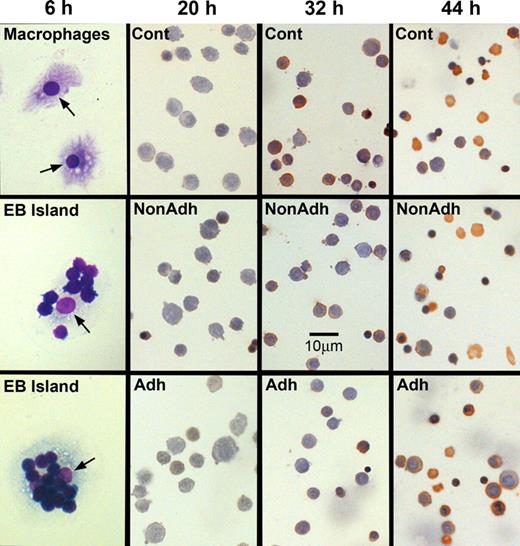 Figure 1. Erythroblastic islands can be reconstituted with splenic macrophages and developmentally synchronized CFU-E/proerythroblasts from the spleens of Friend virus-infected mice. (Left) Photomicrographs of cultures fixed in situ at 6 hours of coculture. (Top panel) Purified, Wright-stained splenic macrophages attached to tissue culture plates. These macrophages did not receive erythroblasts for coculture. The lower 2 panels in the left column show adherent erythroblasts that reconstituted erythroblastic islands at 6 hours of coculture. Arrows point to macrophage nuclei. The remaining columns show photomicrographs of 3,3′-dimethoxybenzidine and hematoxylin-stained cytocentrifuge preparations of control erythroblasts cultured without macrophages (Cont), nonadherent erythroblasts from cocultures with macrophages (NonAdh), and erythroblasts that were adherent to macrophages (Adh) at 20, 32, and 44 hours of culture. At 20 hours, almost all cells are proerythroblasts, which accumulate heme (amber stain) by 32 hours. At 44 hours, control and nonadherent cultures have numerous reticulocytes (enucleated, amber cells) and extruded nuclei (dense, round, purple bodies). Slightly fewer adherent cells have enucleated at this time. Bar represents 10 μm.