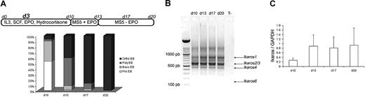 Figure 1. Ikaros expression during cytokine induced erythroid differentiation. (A) Highly purified CD34+ cells from human CB or from human adult mPB samples were maintained in conditions that drive differentiation to the erythoid lineage. On day 3, cells were transduced with EF1 GFP or EF1 IK6 vectors. Cultures were stopped on day 20 for CB samples, and on day 17 for mPB samples. On days 10, 13, 17, and 20, erythroblast subsets derived from CD34+ CB cells were identified by May-Grünwald-Giemsa staining. Results are expressed as the mean percentage in 7 independent experiments. (B) On days 10, 13, 17, and 20, total RNA was extracted from cultured erythroid cells in CB samples, and expression of endogenous Ikaros isoforms was visualized by ethidium bromide staining of 2% agarose gel after RT and 40 cycles of amplification of cDNA with primers designed to match exons 2 and 7 (Ikaros isoforms in Table S1) in order to amplify all Ikaros isoforms. Arrows indicate the positions of Ik1-, Ik2/3-, and Ik4-expressed isoforms. (C) On days 10, 13, 17, and 20, total RNA was also extracted from adult cultured erythroid cells. Expression of Ikaros in CB was quantified using quantitative PCR and normalized relatively to endogenous GAPDH gene expression. Results are shown with means (± SEM) for 4 to 7 independent CB samples.