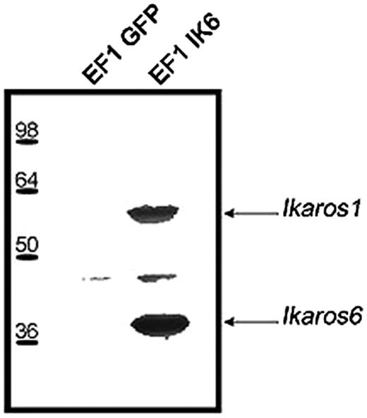 Figure 2. Expression of transgenic Ik6 in transduced CB cells. Protein extracts of transduced EF1 GFP or EF1 IK6 CB cells were immunoprecipitated at day 7 with an anti-Flag epitope antibody, and analyzed by Western blotting with anti-Ikaros antibody. Arrows indicate the position of Ik1 and Ik6 immunodetected proteins.