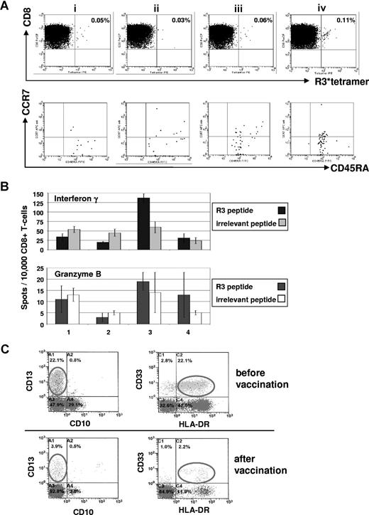 Figure 2. Immunologic and clinical responses of patient no. 1 with acute myeloid leukemia to the course of RHAMM-R3 peptide vaccination. (A) The FACS dot plots show the percentage of HLA-A2/R3-tetramer+/CD8+ T lymphocytes. The frequency of CD8+/HLA-A2/R3-tetramer+ T lymphocytes increased after 4 vaccinations (i represents before; ii, after second; iii, after third; and iv, 2 weeks after fourth/last vaccination). The HLA-A2/R3-tetramer*PE–positive CD8+ T cells were further analyzed for their expression of CCR7 and CD45RA. Most of the cells (70%-85%) revealed to be CD8+/HLA-A2/R3 tetramer+/CCR7−/CD45RA+ effector T cells. (B) The frequency of R3-specific CD8+ T lymphocytes increased during the course of vaccination as assessed by ELISpot assays for IFN-γ and granzyme B release. All assays were performed in triplicate. Error bars indicate the SD. (C) Monitoring of malignant cells correlated with the other findings showing a decrease of CD33+/HLA-DR+ malignant cells during vaccination. Numbers on plots are percentages of all lymphocytes (panel A), or of cells in the blast gate (panel C), respectively.