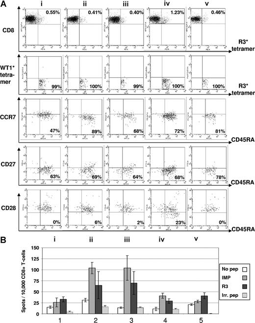 Figure 3. Immunomonitoring for R3-specific CD8+ T lymphocytes in patient no. 8 with multiple myeloma. (A) The dot plots show the percentage of HLA-A2/R3-tetramer+/CD8+ T lymphocytes. Six-color staining for R3-specific CD8+ T lymphocytes revealed an increase of CD8+/HLA-A2/R3-tetramer+ T lymphocytes over 4 vaccinations and a decrease thereafter (i represents before; ii, after first; iii, after second; iv, after third; and v, 3 weeks after fourth/last vaccination). The HLA-A2/R3-tetramer*PE–positive CD8+ T lymphocytes could not be counterstained by WT1-tetramers demonstrating their specificity for the peptide R3. The staining for CCR7 and CD45RA demonstrated an increase of CD8+/HLA-A2/R3 tetramer+/WT1 tetramer−/CCR7−/CD45RA+ effector T cells from 47% to 81%. The frequency of CD8+/HLA-A2/R3 tetramer+/WT1 tetramer−/CCR7−/CD45RA+/CD27− effector T cells rose from 63% up to 78%. The CD8+/HLA-A2/R3 tetramer+/WT1 tetramer−/CCR7−/CD45RA+/CD28− effector T cells increased over 4 vaccinations, but decreased 3 weeks thereafter. Numbers on plots are percentages of all lymphocytes. (B) The results of the ELISpot assay for granzyme B correlated with the FACS data showing an increase and subsequent decrease of R3-specific CD8+ T-lymphocyte function during the course of vaccination. All assays were performed in triplicate. Error bars indicate the SD.