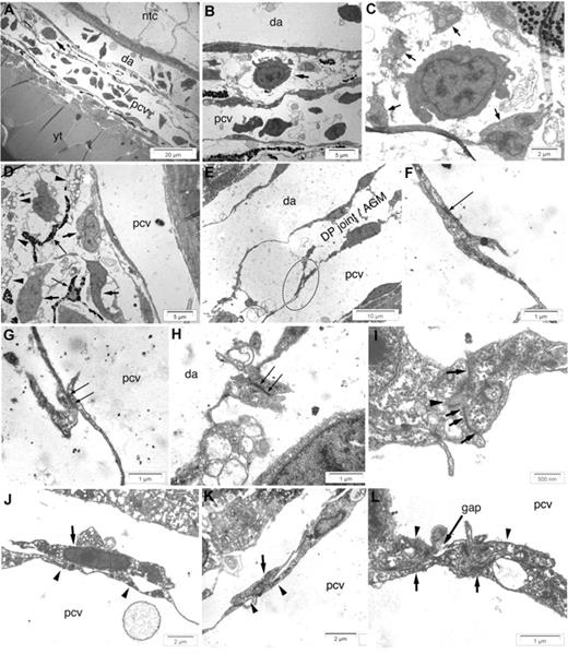 Figure 4. Ultrastructure of the zebrafish AGM. Electron microscopy of longitudinal sections of the DP joint at 48 hpf (A-D), 26 hpf (E-H,K,L), and 36 hpf (I,J). (A,B) An hematopoietic early precursor (arrows) visible in the DP joint (A) is shown at higher magnifications in (B). (C) A similar precursor, at higher magnification, surrounded by processes of mesenchymal cells (arrows). (D) Structure of the DP joint mesenchyme, with irregular mesenchymal cells (arrows), lipid-laden cells (arrowheads), and melanin-laden pigment cells (thin arrows). (E) Typical overlap (dotted ellipse) between adjacent endothelial cells of the PCV dorsal wall, in contrast with the continuous appearance of the DA endothelial wall. (F,G) Higher magnification of the thin overlapping processes of adjacent PCV endothelial cells, showing cell junctions between them (arrows), though shorter and less dense than those between endothelial cells of the DA (H, arrows). (I) Adjacent DA endothelial cells also show interdigitations penetrating each other (arrowhead), in addition to cell junctions (arrows). (J) Intimate apposition between a stromal reticular cell (arrow) and PCV endothelium (arrowheads). (K) A stromal reticular cell (arrow) bridging a short gap between 2 adjacent PCV endothelial cells (arrowheads). (L) Two endothelial cells (arrowheads) keeping a gap, underlaid by 2 stromal reticular cells (arrows), one of which covers the gap. Ntc indicates notochord; and yt, yolk tube.