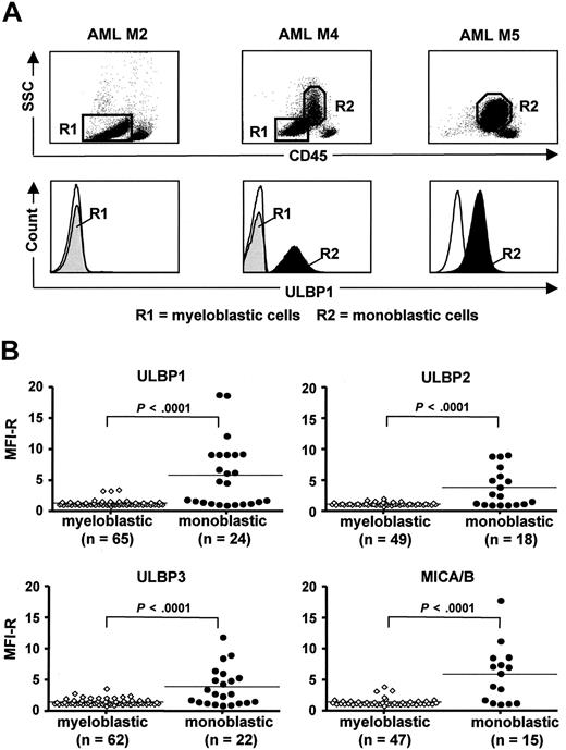 Figure 1. Expression of cell surface NKG2D-L by myeloblastic and monoblastic cells in AML and CMML. (A) FACS analysis of ULBP1 expression by AML peripheral blood cells of 3 patients with AML M2, M4, and M5. Gating of myeloblastic CD45-dim (R1) and monoblastic CD45-intermediate (R2) is shown in top panels, according to side scatter (SSC) and CD45 expression level. Histograms of ULBP1 expression by myeloblastic cells (R1, gray area) and monoblastic cells (R2, black area) are shown in bottom panels. (Thin line) Staining with secondary mAb. (B) Summary of ULBP1, ULBP2, ULBP3, and MICA/B expression levels, defined as MFI-R, by monoblastic and myeloblastic cells in all analyzed AML (n = 66) and CMML (n = 3) patients (for details on individual patients, see Table S1). Horizontal bars show the median values. (P < .001, significant difference in NKG2D-L expression levels by 2 types of leukemic blasts.)