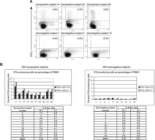 Figure 1. Healthy EBV-seropositive patients can be distinguished from healthy EBV-seronegative patients based on production of IFNγ by PBMC in response to autologous LCL. (A) FACS dotplots of PBMC from healthy EBV-seropositive subjects 14, 22, and 26 or healthy EBV-seronegative subjects 1, 2, and 15 producing IFNγ by intracellular staining after 20 hours of culture with autologous LCL (PBMC/LCL = 5:1). (B) Comparison of percentage of PBMCs producing IFNγ between 10 healthy EBV-seropositive and 10 healthy EBV-seronegative patients after culture with autologous LCL at ratios of 10:1 or 5:1 (PBMC/LCL).