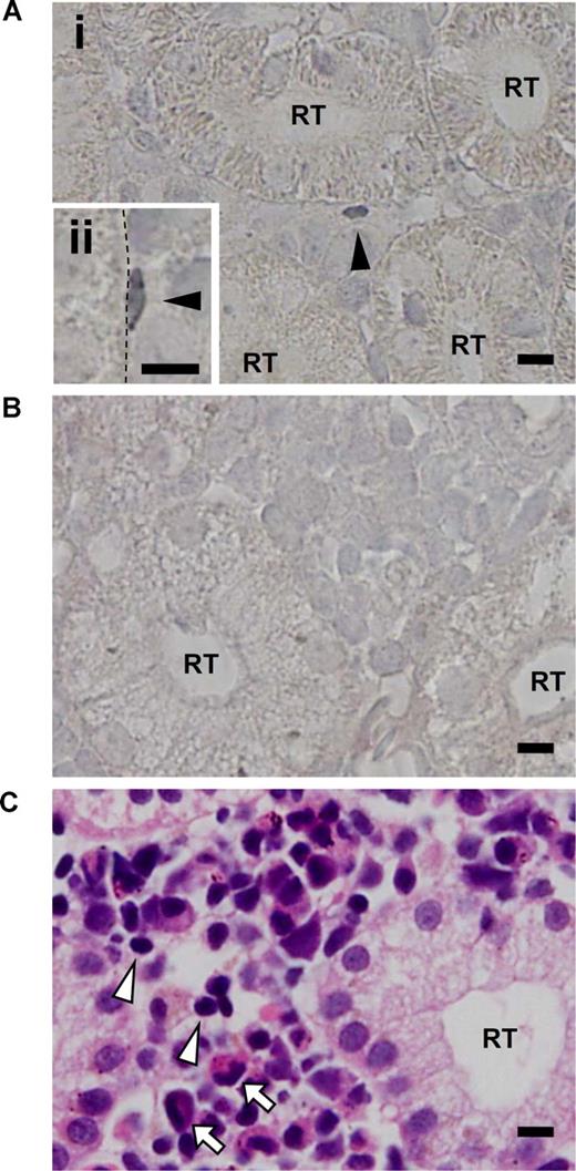 Figure 7. Results of in situ hybridization of zAbcg2a in zebrafish kidney. (A) Tissue section in situ hybridizations with antisense RNA probe for zAbcg2a on body kidney are shown. Arrowheads indicate zAbcg2a-positive cells. Dashed line indicates the surface of renal tubule. (B) Tissue section in situ hybridization with sense RNA probe for zAbcg2a on body kidney is shown. (C) Body kidney section stained with hematoxylin eosin (H-E) is shown. Arrowheads and arrows indicate lymphoid cells and myeloid cells, respectively. All scale bars indicate 5 μm. RT indicates renal tubule.