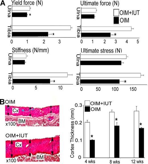 Figure 3. IUT increases long bone strength and cortical thickness. (A) Mechanical properties (3-point bending test) of ulna and tibia in 4-week-old mice that received transplants (OIM + IUT; n = 8) and oim mice that did not receive transplants (OIM; n = 4). Yield force (N), ultimate force (N), stiffness (N/mm), and ultimate force (N). *P < .05. (B) Femoral cortical thickness in 4-week-old (n = 6), 8-week-old (n = 4), and 12-week-old (n = 3) OIM + IUT and OIM mice (n = 7, 4, and 4, respectively). Cx indicates cortex; and BM, bone marrow. Bars on graphs are means ± SE.