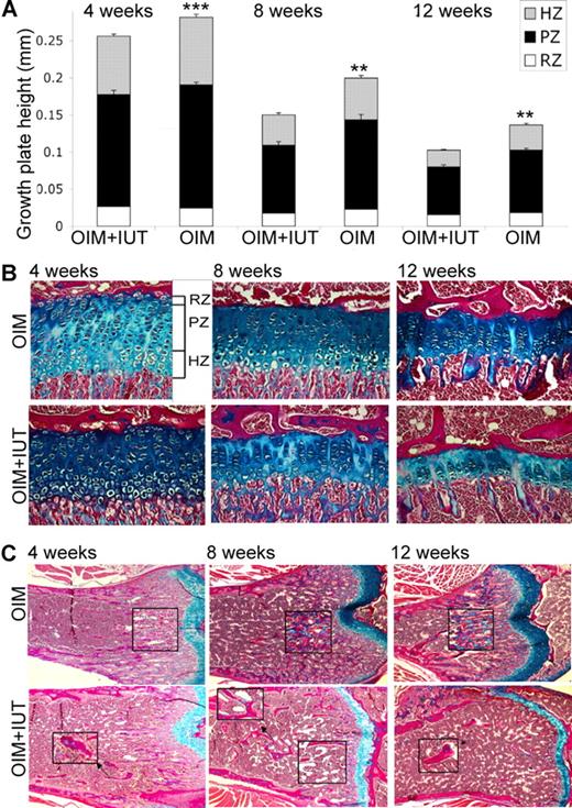 Figure 4. IUT decreases growth plate height. (A) Tibial growth plate analysis in 4-week-old (OIM + IUT, n = 7; OIM, n = 12), 8-week-old (OIM + IUT, n = 9; OIM, n = 11), and 12-week-old (OIM + IUT, n = 3; OIM, n = 5) mice. The heights of the total GP, RZ, PZ and HZ are shown (± SE). **P < .01; or ***P < .001. (B) Tibial sagittal sections showing growth plates in 4-, 8- and 12-week-old OIM + IUT and OIM mice. (C) Femur sagittal sections under the growth plate showing trabeculae and calcified cartilage (magnified inserts) in OIM versus OIM + IUT mice at 4, 8, and 12 weeks of age. Magnification was 200×.