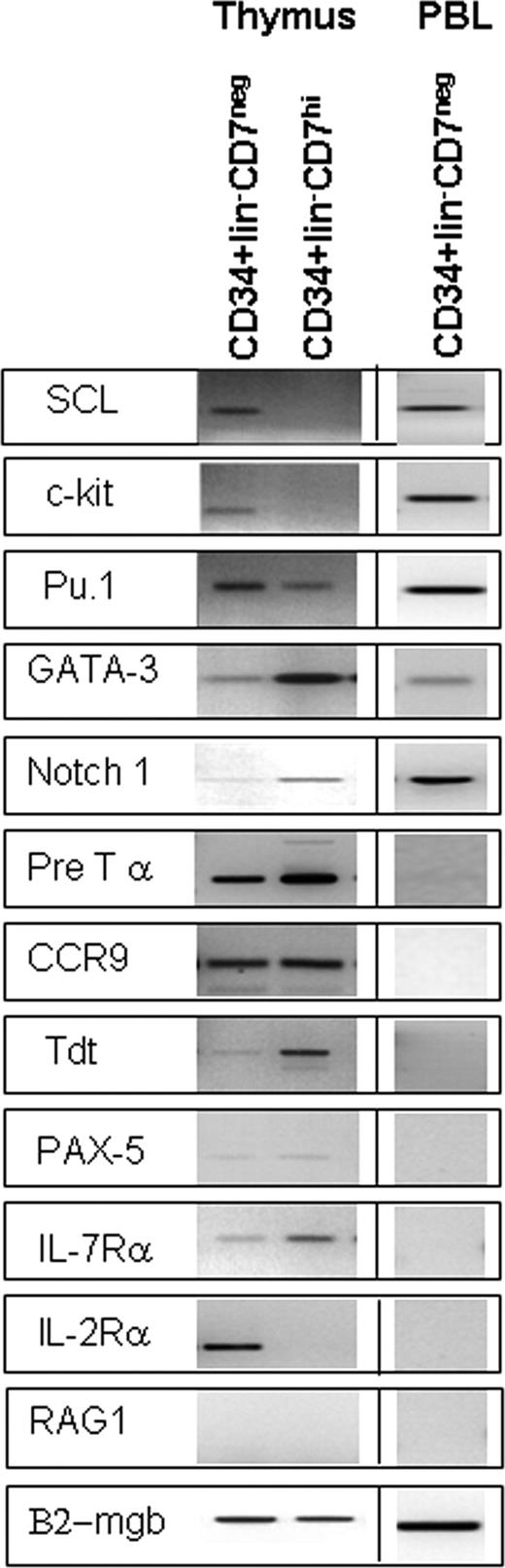 Figure 2. Expression of stem cell– and lymphoid-associated genes in CD34+lin− subsets from thymus and blood. Equal numbers of CD34+lin−CD7hi and CD34+lin−CD7− cells from thymus and CD34+lin−CD7− cells from normal peripheral blood (PBL) were isolated by FACS and subjected to RT-PCR analysis to define the expression levels of selected stem- and lymphoid-associated genes. All results were confirmed at least twice using independently sorted cells from different thymuses.